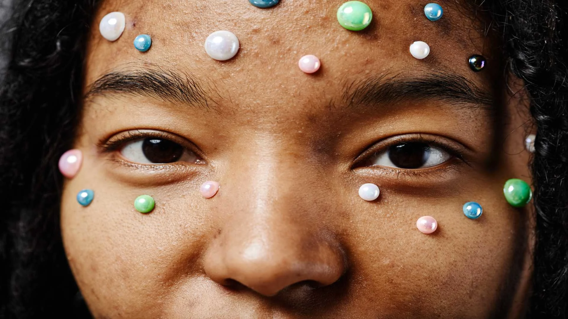 A picture depicting mental health issues related to taking too many pills with colorful pill pimples on woman's face.