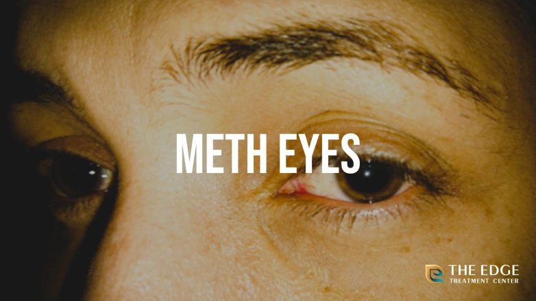 What are Meth Eyes?