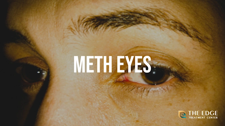 Meth Use Rash Meth Before And After Pictures Of People On Meth