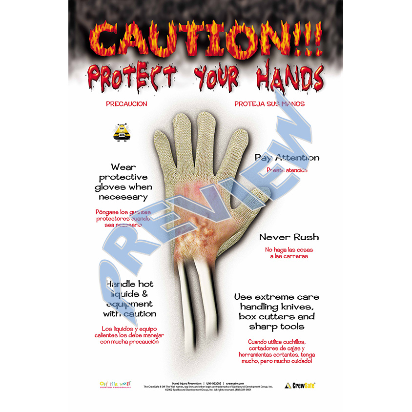 hand injury safety