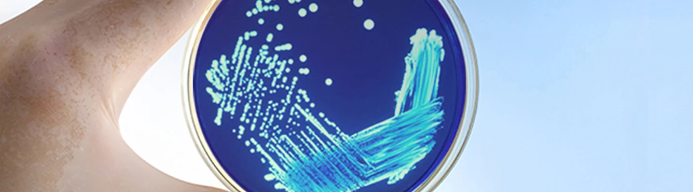 Hand holding a petri dish with blue agar and teal bacterial colonies growing.