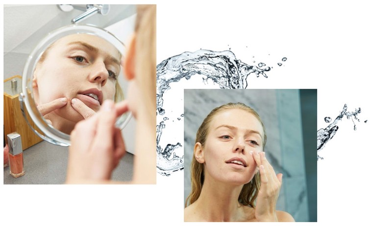 ne stiskajte mozoljev