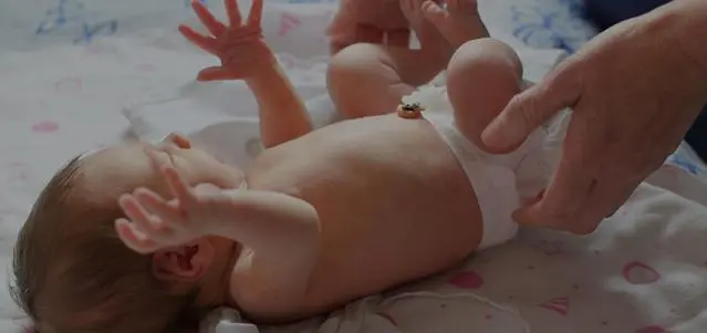 Umbilical Cord Care