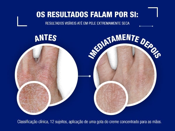 Creme de Mãos Concentrado Sem Perfume Neutrogena® Fórmula Norueguesa® image 2