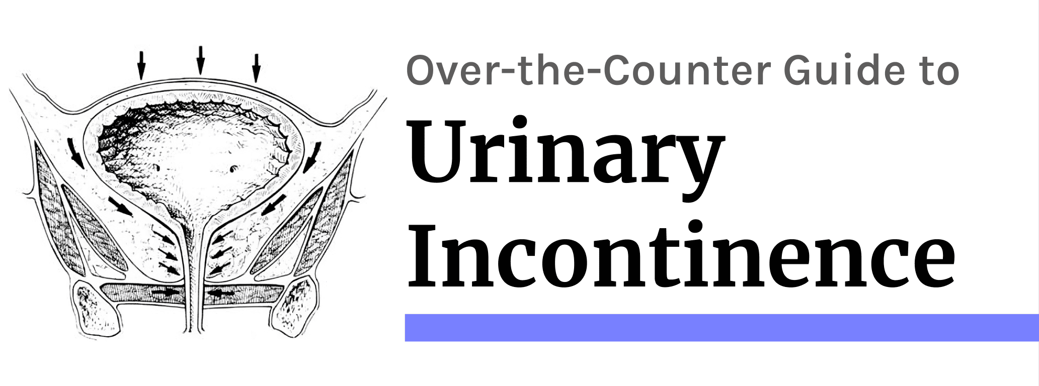 Urinary Incontinence: Best Evidence for At-Home Management