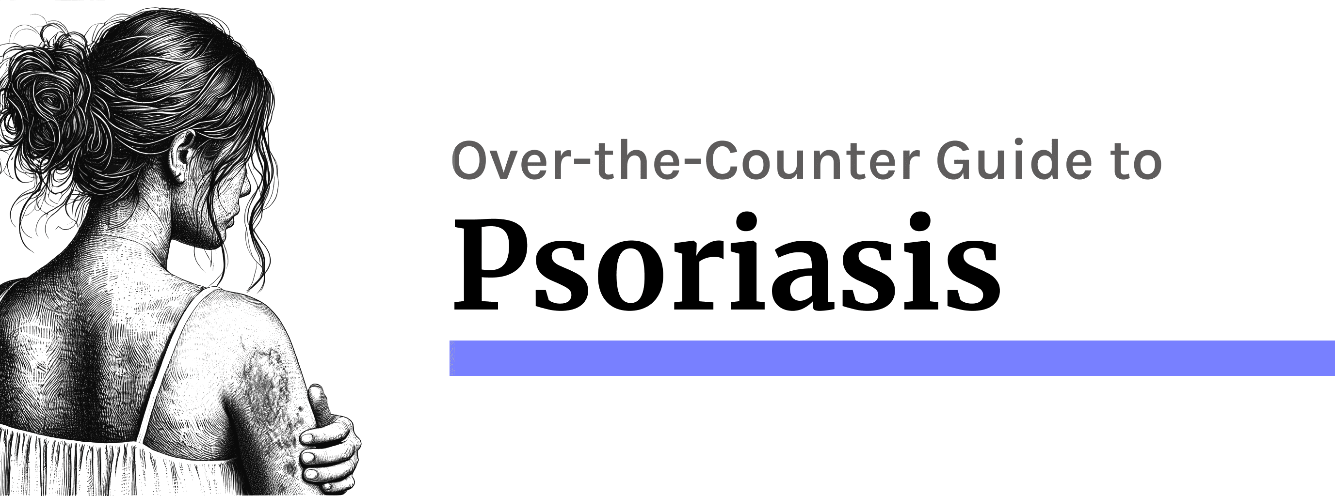 Psoriasis: Best Over-the-Counter Management Steps