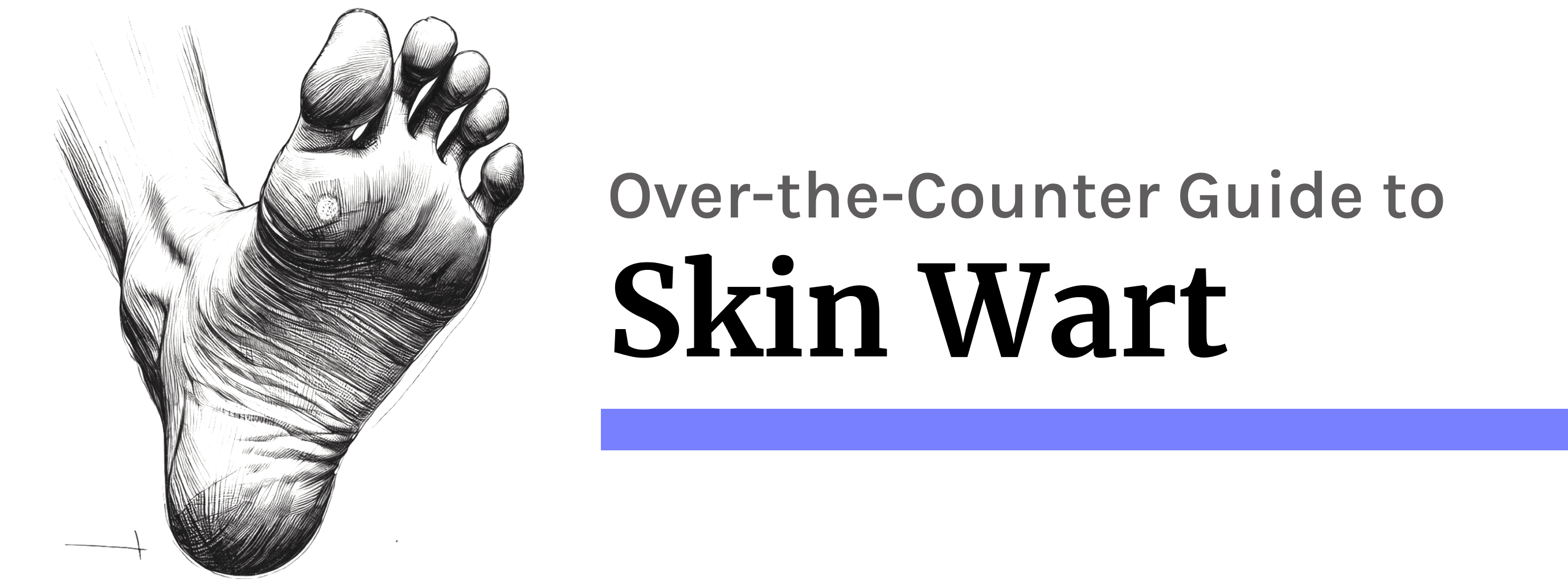 Skin Warts: At-Home Removal