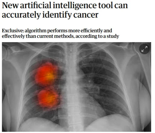 ai finds cancer