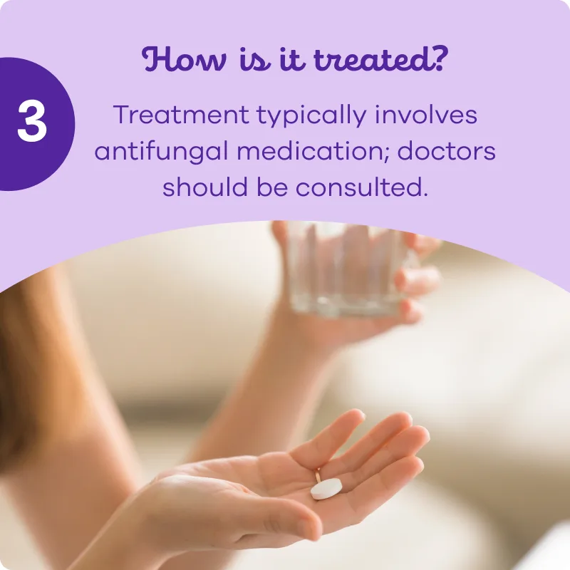 Woman hands holding a pill and a glass of water with the message how yeast infection is treated