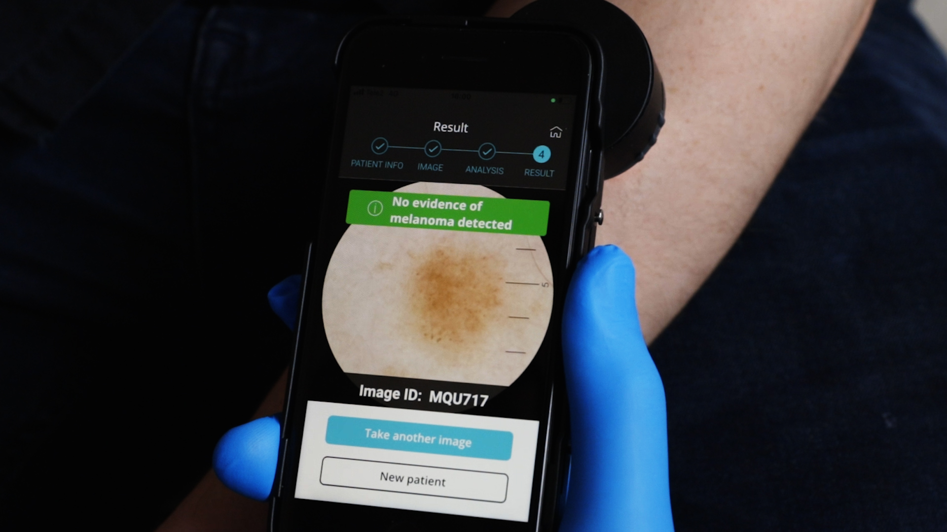 AI Medical Technologies