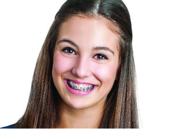 At any one time, millions of Americans are using dental braces. Not that long ago, patients didn’t have any options when it came to their orthodontic treatment.