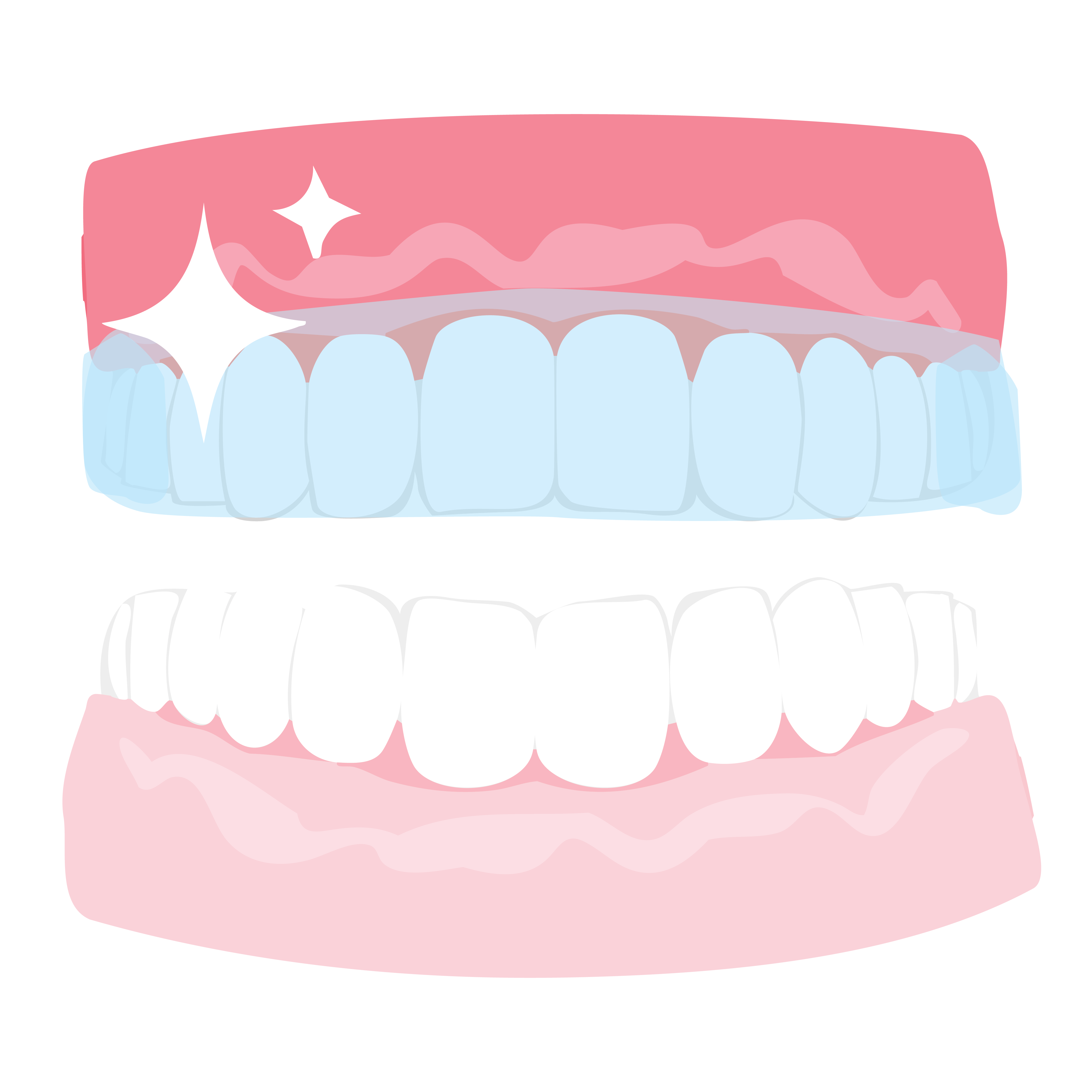 Mouthguard on top row of teeth to prevent teeth grinding while sleeping 
