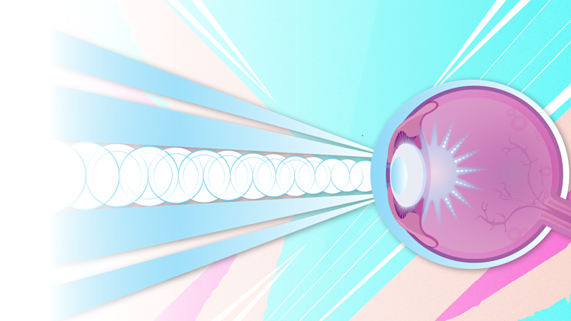 June is Cataract Awareness Month. This makes it a perfect time to learn what cataracts are, when they occur and what to expect if you develop them. 