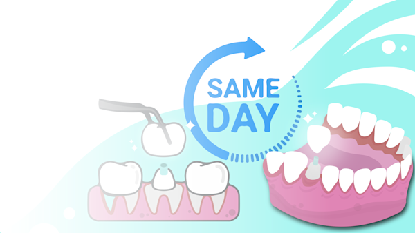 Illustration of a dental crown being installed onto a shaped tooth with a logo advertising "same day". 