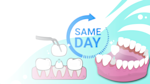 Learn everything about same-day dental crowns, from how they're made to their pros and cons. Discover the latest dental technology that restores smiles in one visit.