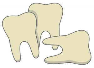 Graphic of 3 loose teeth