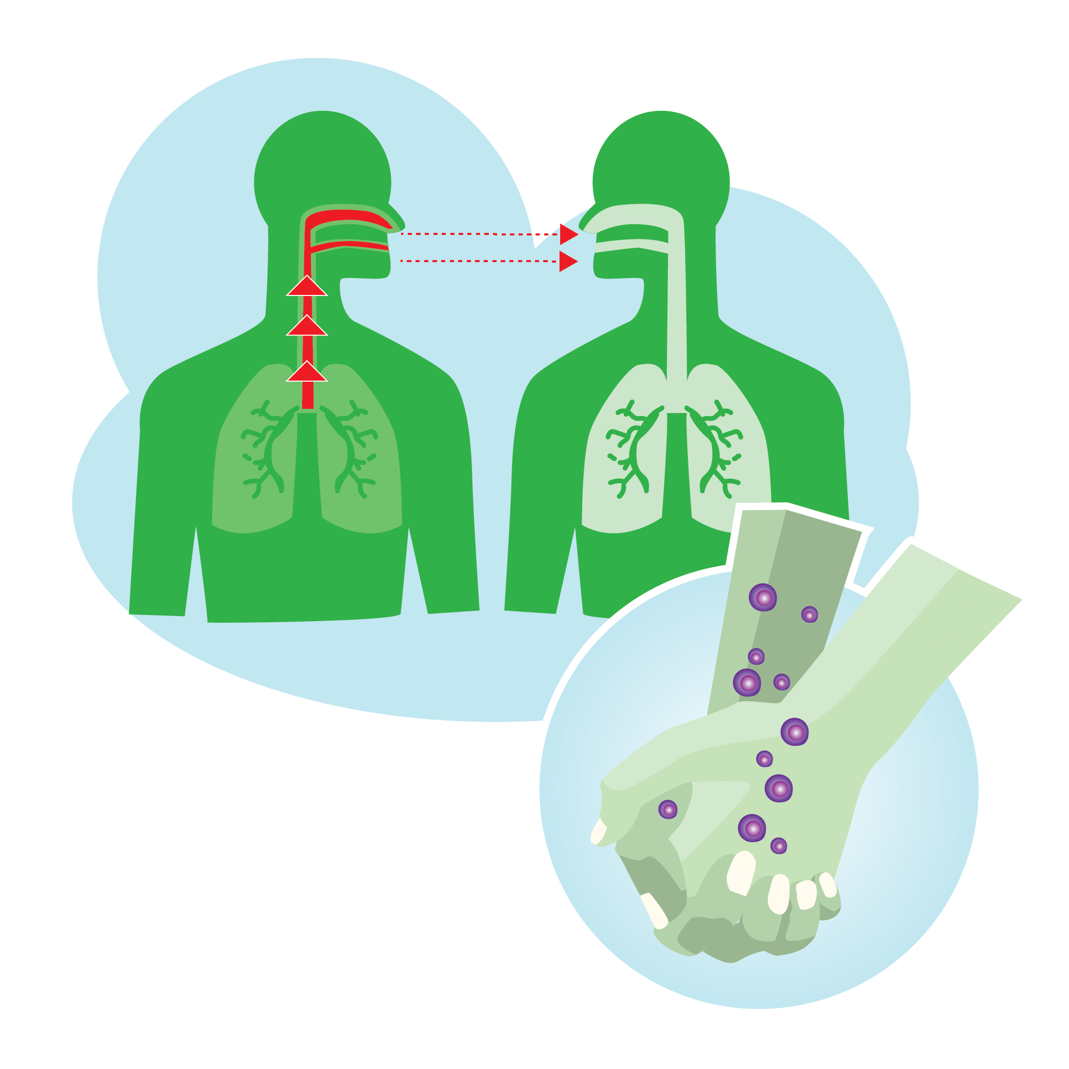 Illustration of two figures in close proximity showing how respiratory particles are shared in the airway and a pair of clasped hands with germ particles on them 
