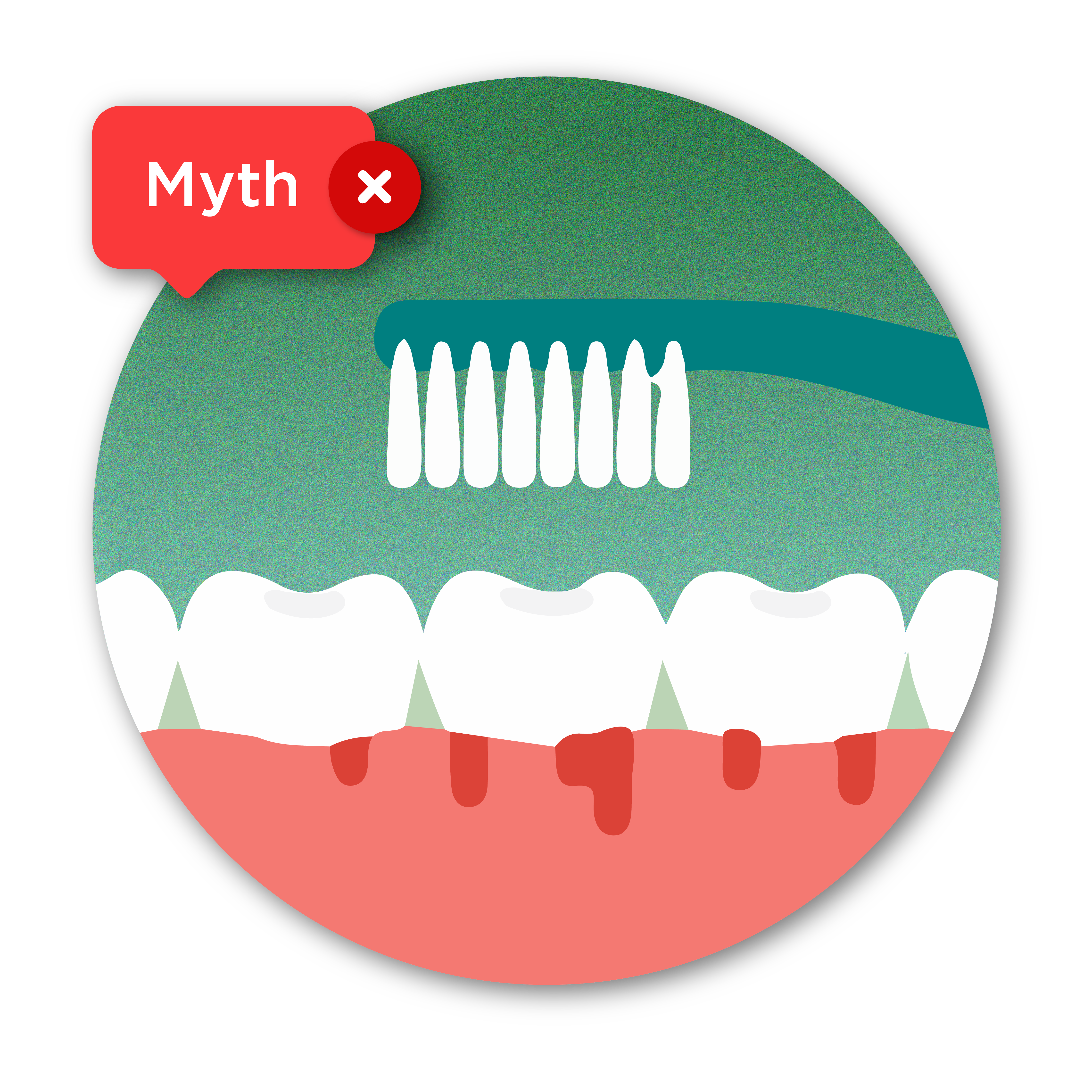 illustration of gums bleeding with a toothbrush 