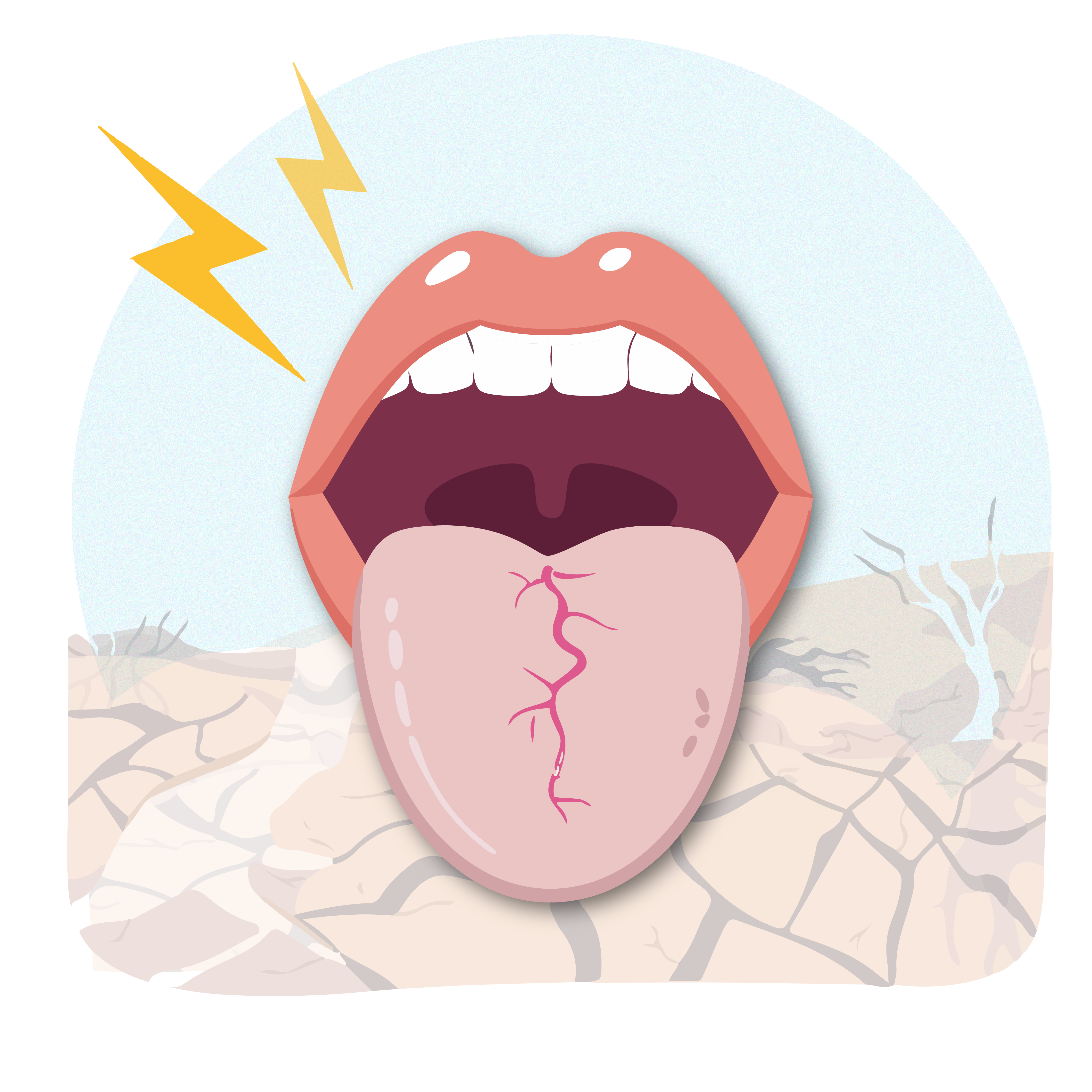 Illustration of a mouth with the tongue sticking out. The tongue is cracked due to dry mouth. There is a cracked desert floor at the bottom of the picture. 