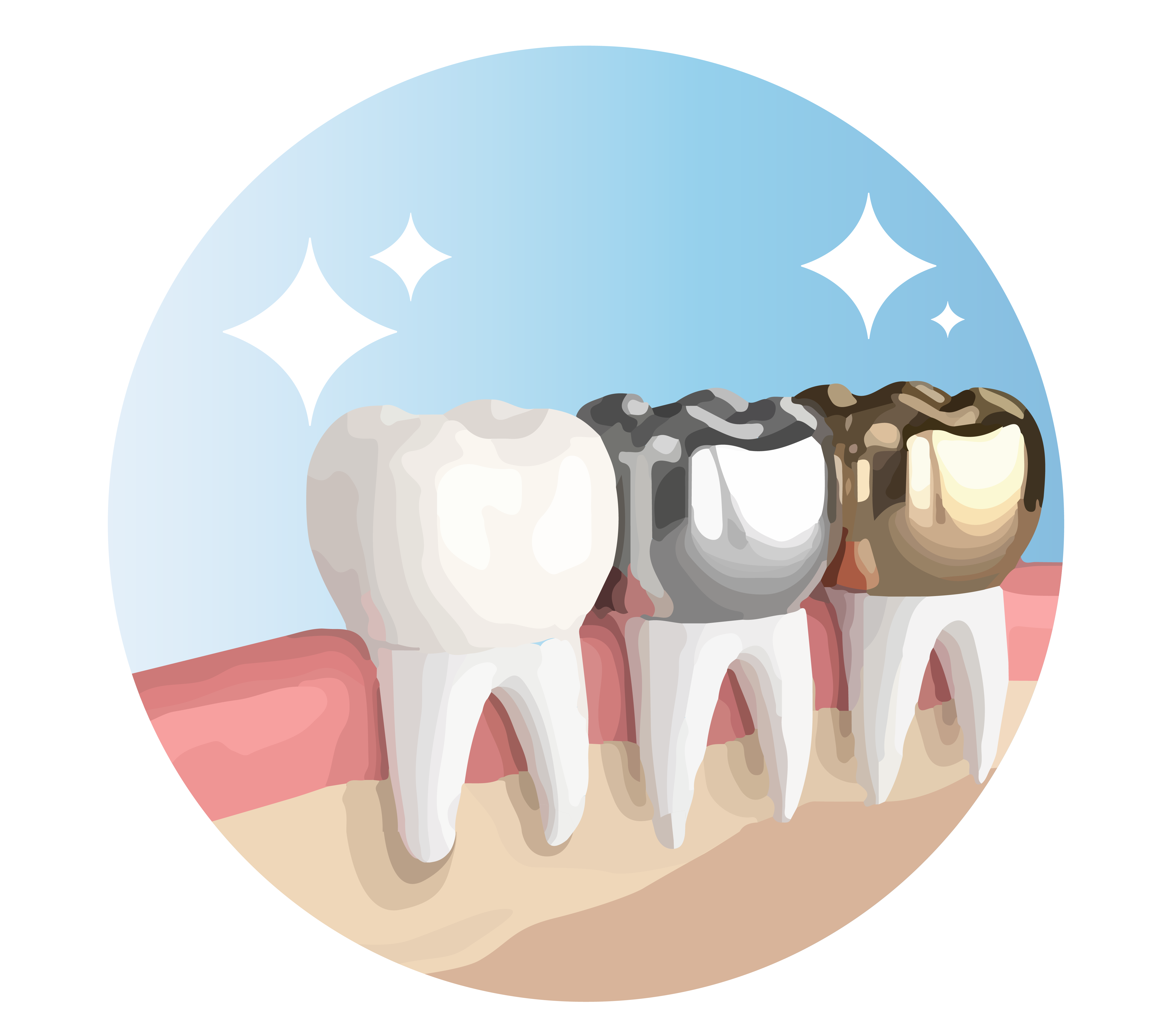 Illustration of a row of teeth showcasing various dental crown materials, including gold, silver, and ceramic, highlighting the options available for restorative dental treatments based on durability and aesthetic preference.