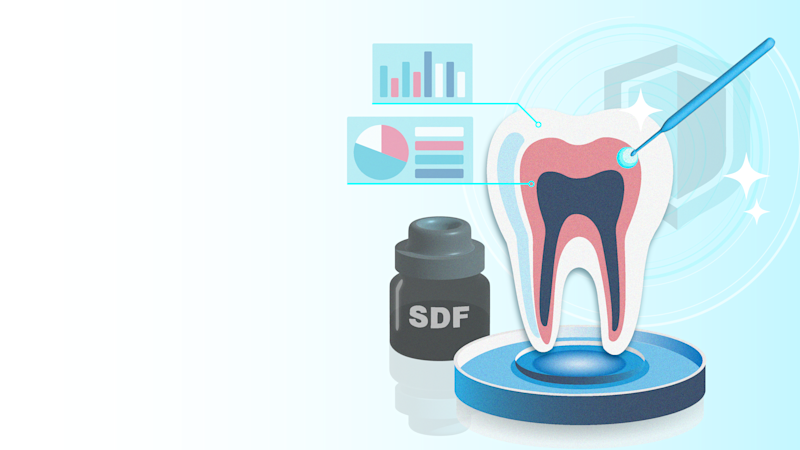 Silver Diamine Fluoride is a treatment used for cavity (dental caries) prevention and management. Learn when and how it can be used.