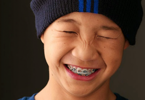 Getting braces can be a big commitment. Here are a few things you can expect and some tips for care after you get them put on. 