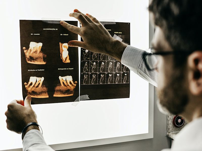 Summer can be a good time to see a dentist about wisdom teeth issues. Wisdom teeth (a third set of molars) come in between the ages of 17 and 25. When wisdom teeth are unable to fully erupt, they can become impacted and require removal. Bring up any concerns you may have about your teeth at your next dental check up.