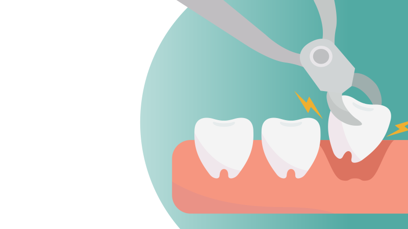 Dry socket is a painful condition that can occur at the site of a tooth removal. Find out how it happens and the best ways to prevent it. 