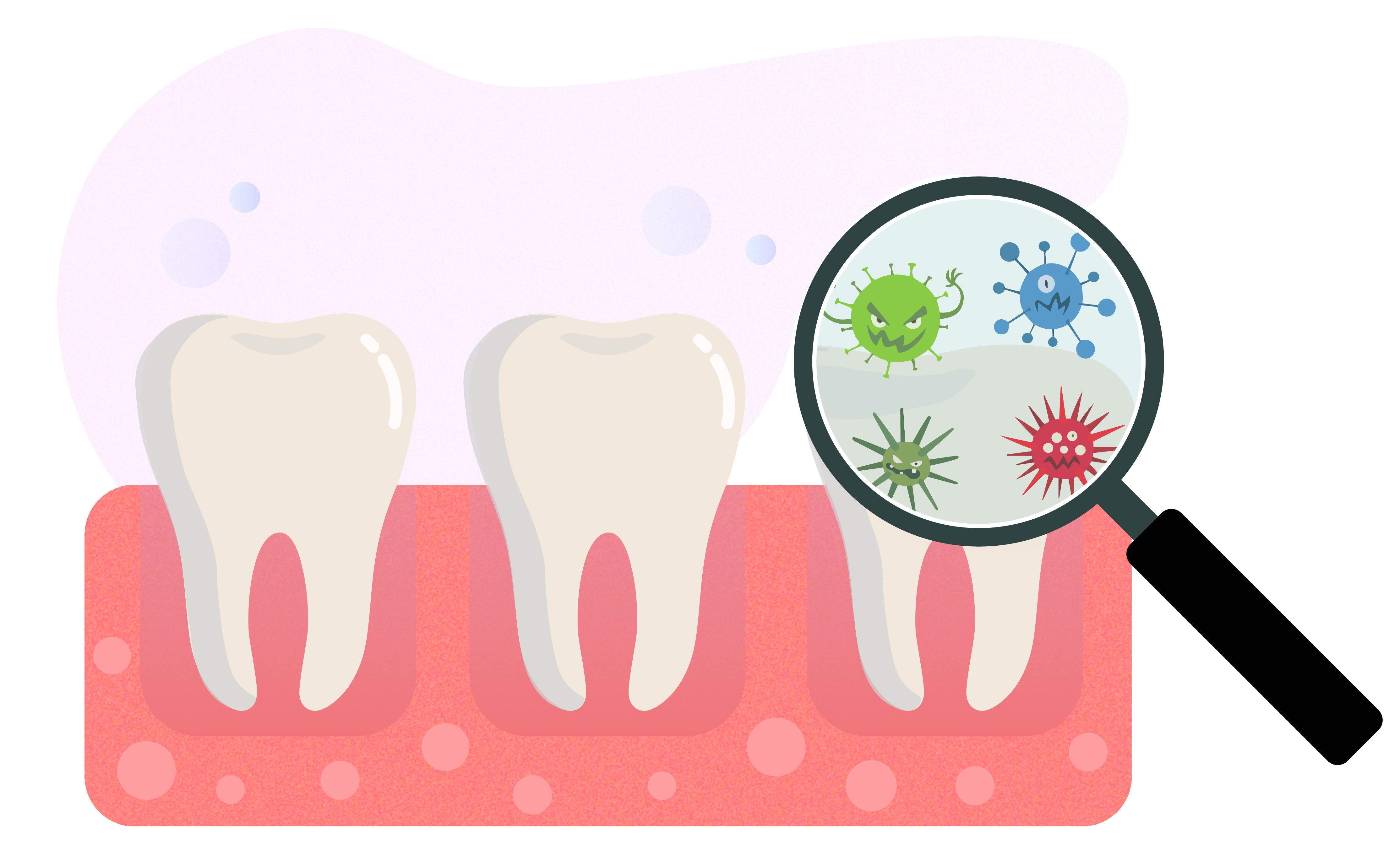 Illustration of germs with mean faces under a magnifying glass on the surface of a tooth