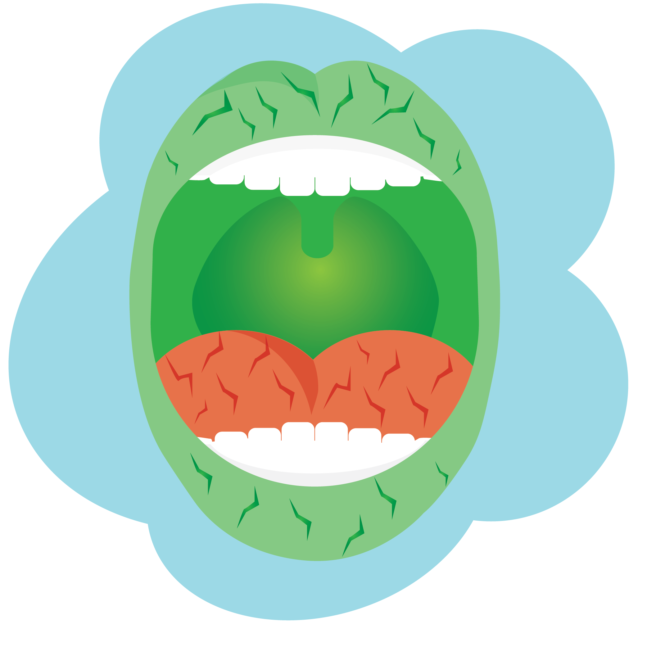 Illustration of dry mouth and tongue