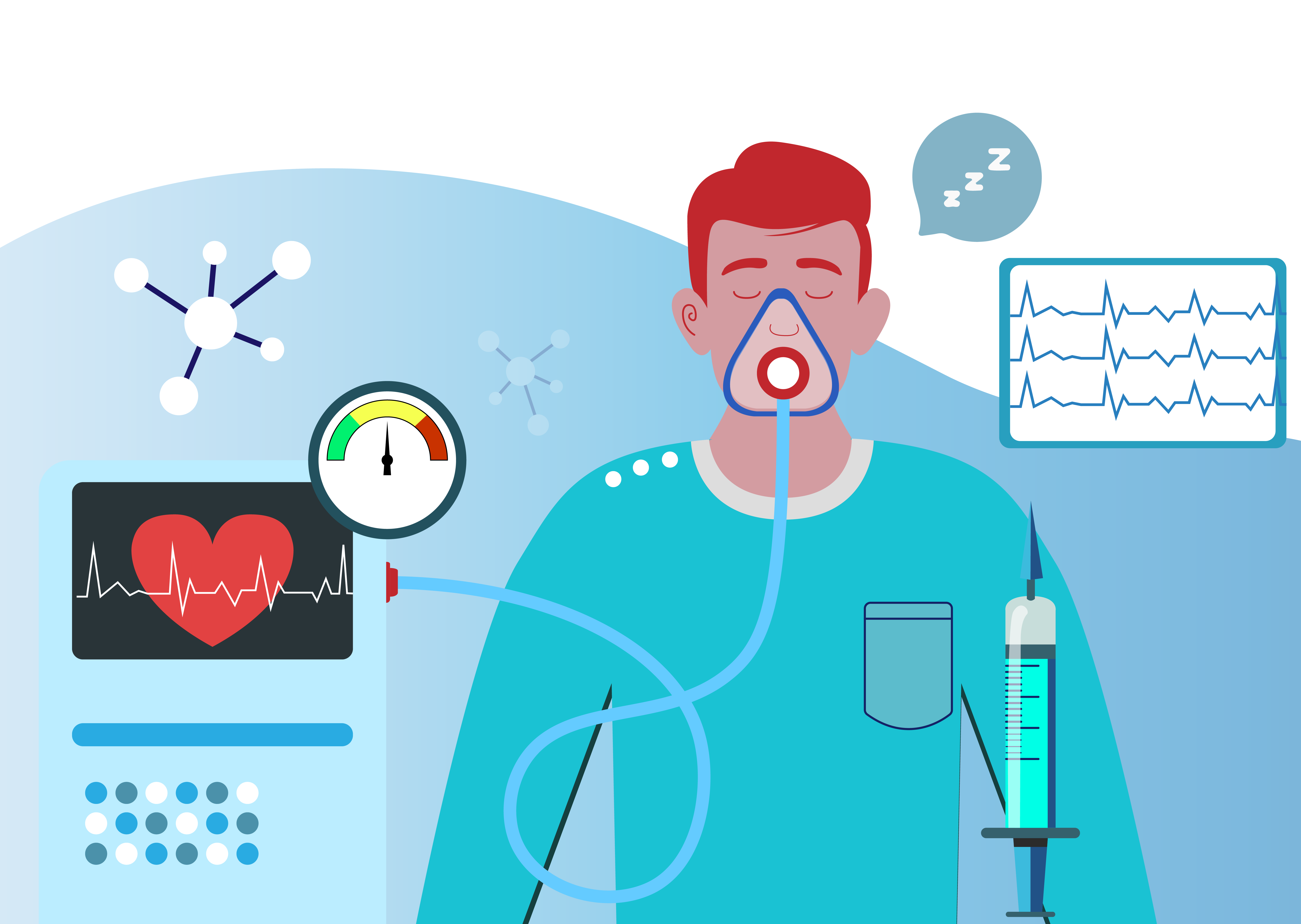 Illustration showing a patient being sedated using general anesthesia in a dental office. The patient's anesthesia is being dispensed via face mask and it is indicated that it is deep sedation by "Zzz" appearing in the image. Their vitals are being monitored by a heart monitor to the side of the image. 