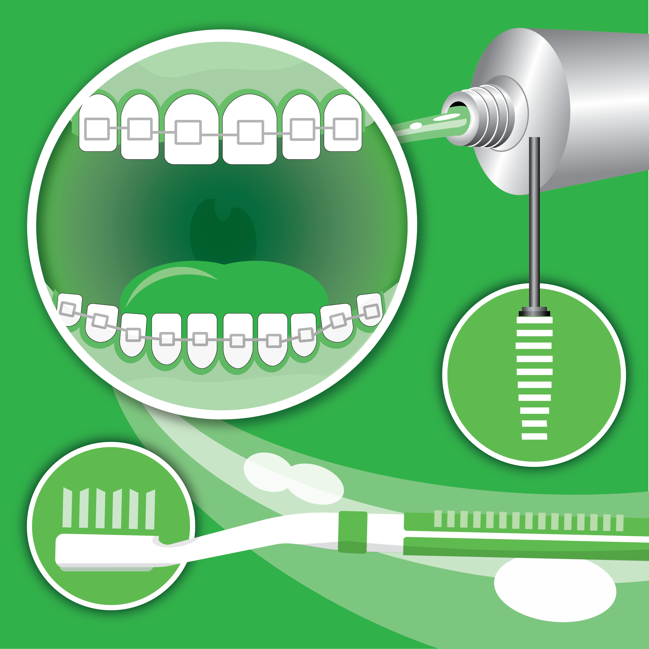 Graphic image of teeth with braces, toothpaste, and toothbrush.