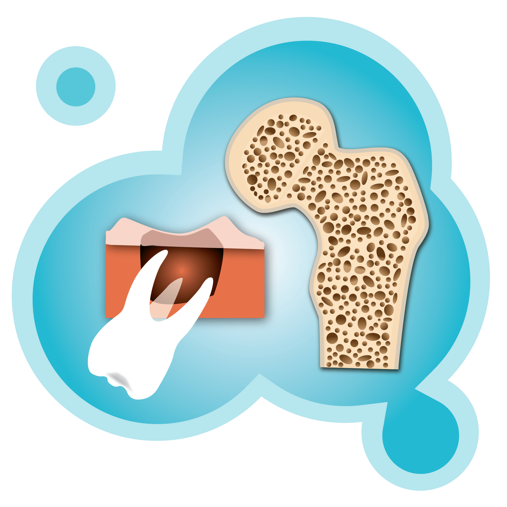 Illustration of a tooth falling out of gums next to an illustration of a bone showing lots of holes to indicate lack of bone density due to certain medications