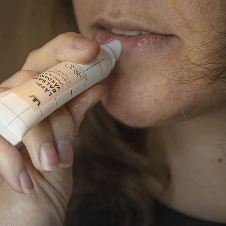 perioral dermatit runt ögon perioral dermatit runt ögon