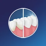 Rimuove le macchie ed è delicato sulla dentiera