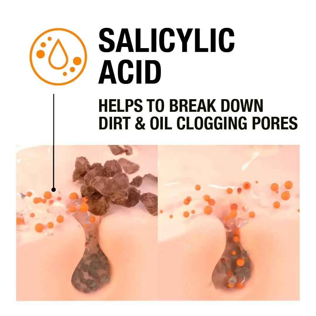 Blackhead Eliminating Face Scrub