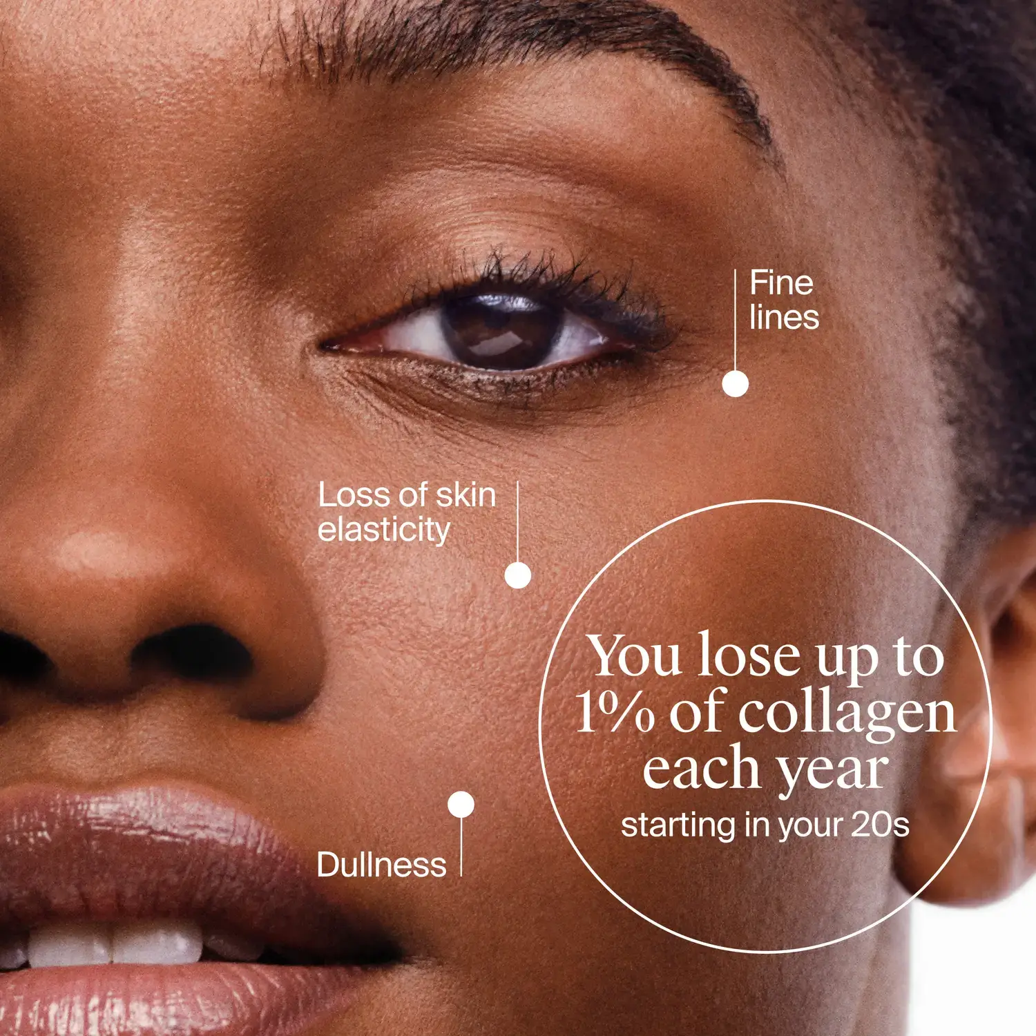 Starting in your 20s, you lose up to 1% of collagen each year