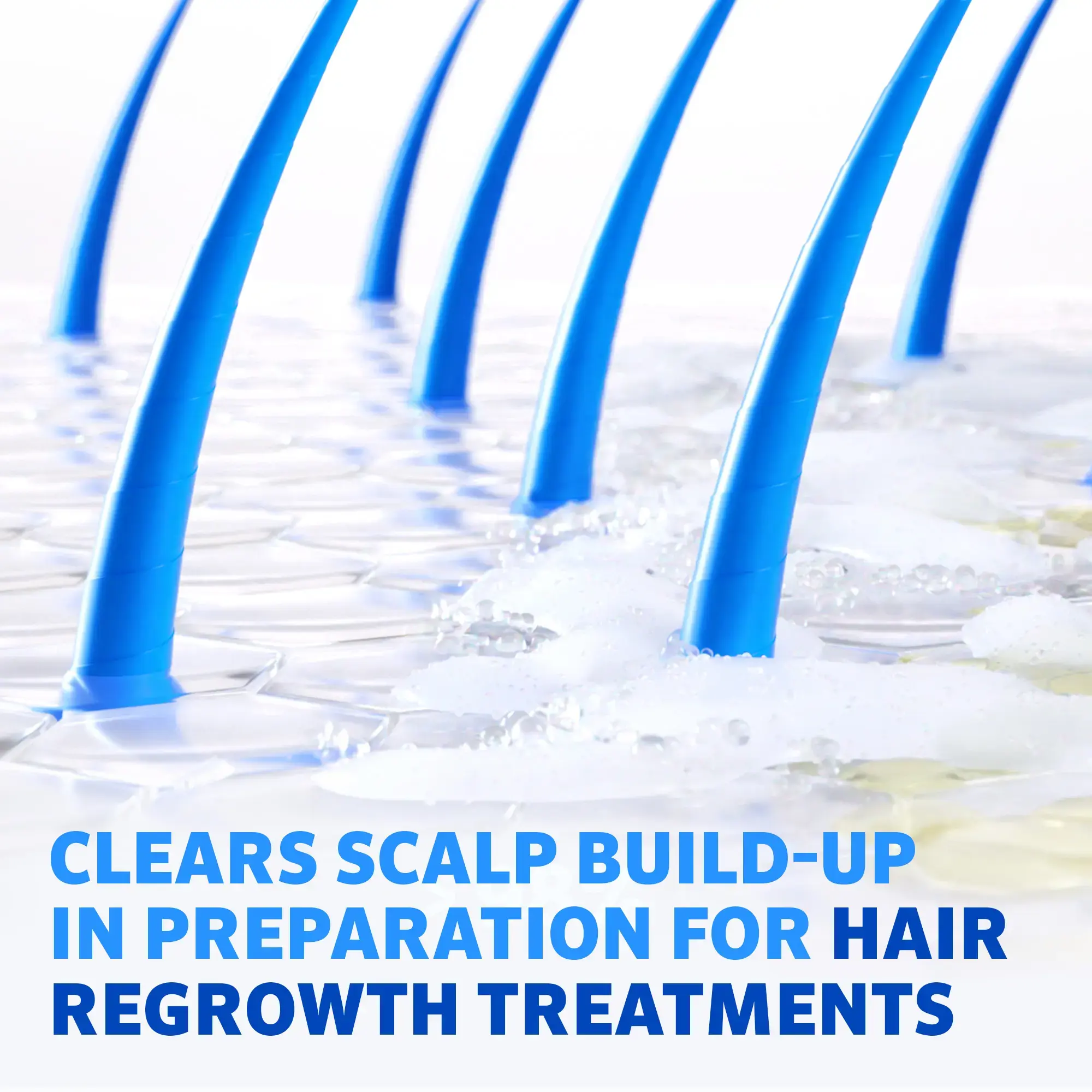 REGAINE® PRE-GROWTH 2IN1 SHAMPOO & CONDITIONER