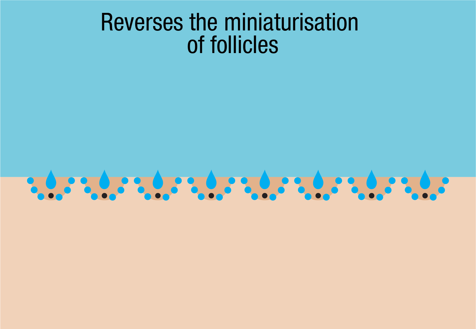 Minaturised hair follicles