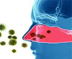 Allergies entering the nose