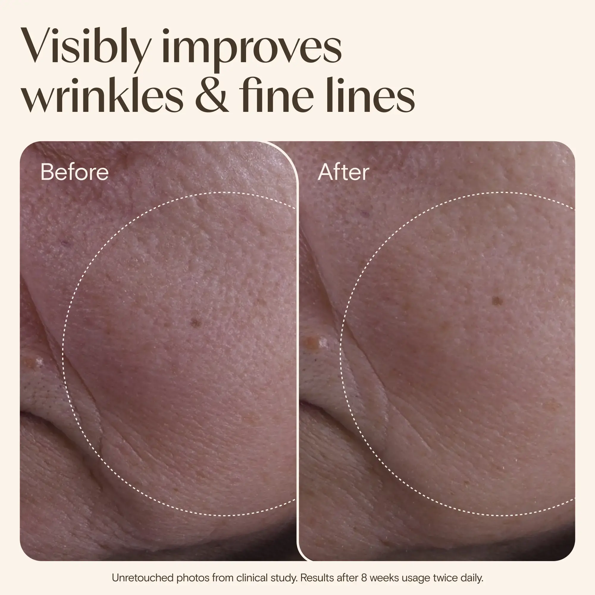 Age_Renewal_Face_Cream_50m-image8