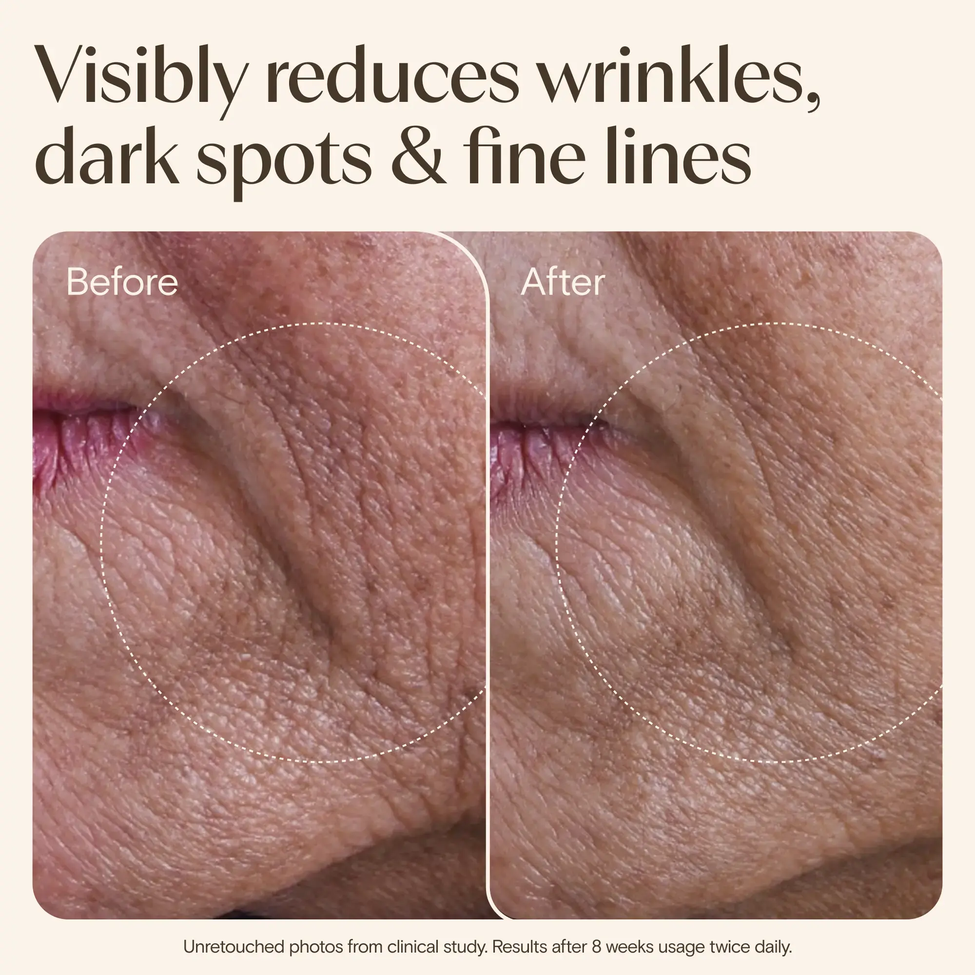 AVEENO® Face Age Renewal Serum 30ml image 8