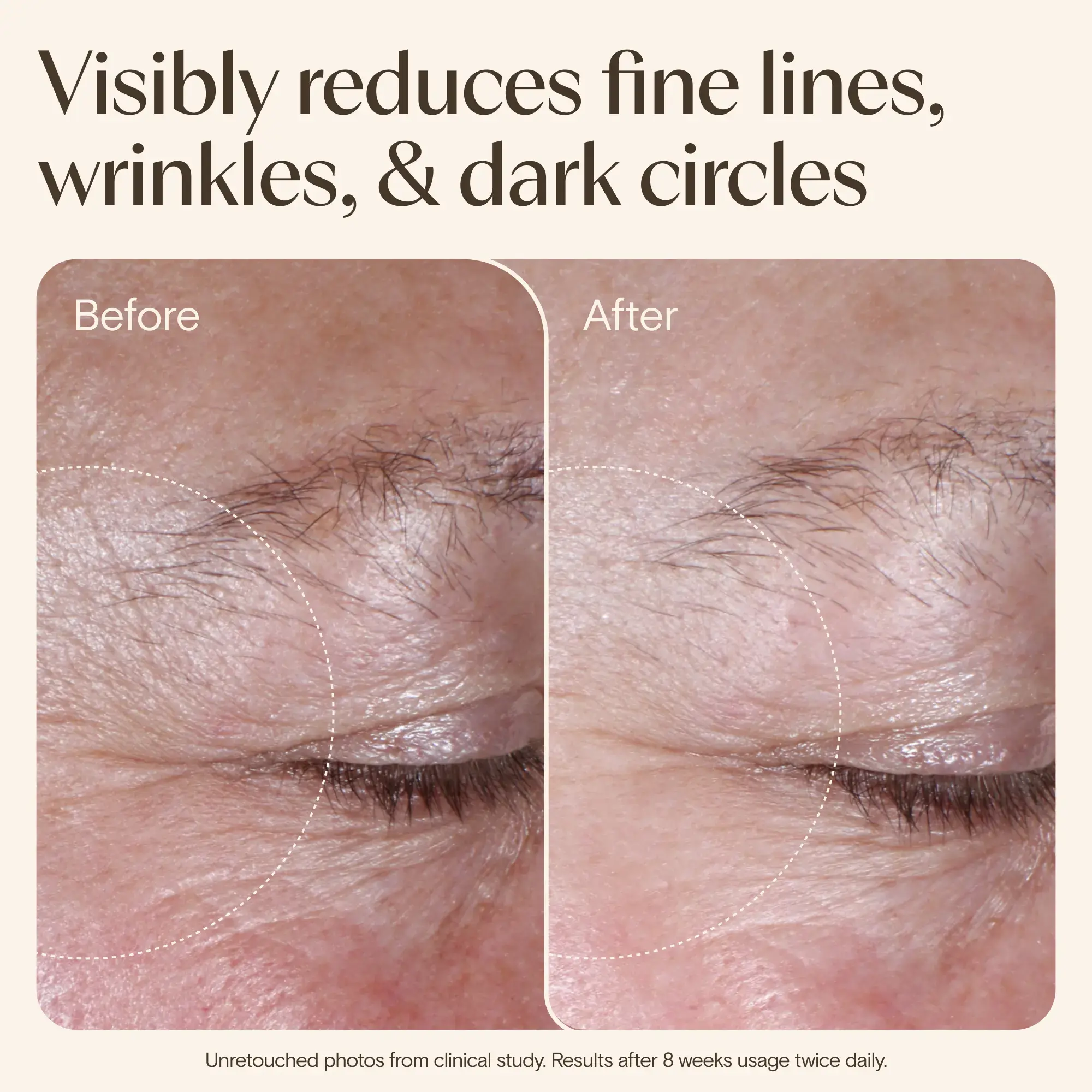 Age Renewal Eye Gel Cream - Image 7