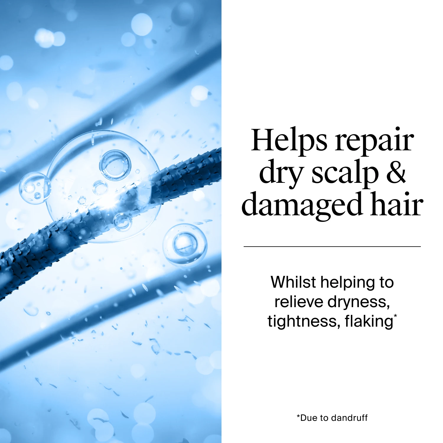 T-gel Developed with dermatologists