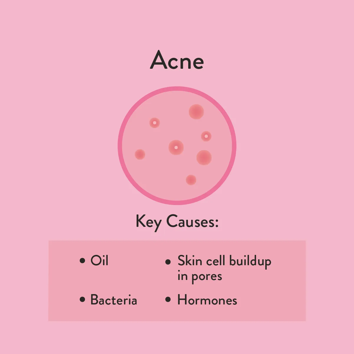 Acne Illustration