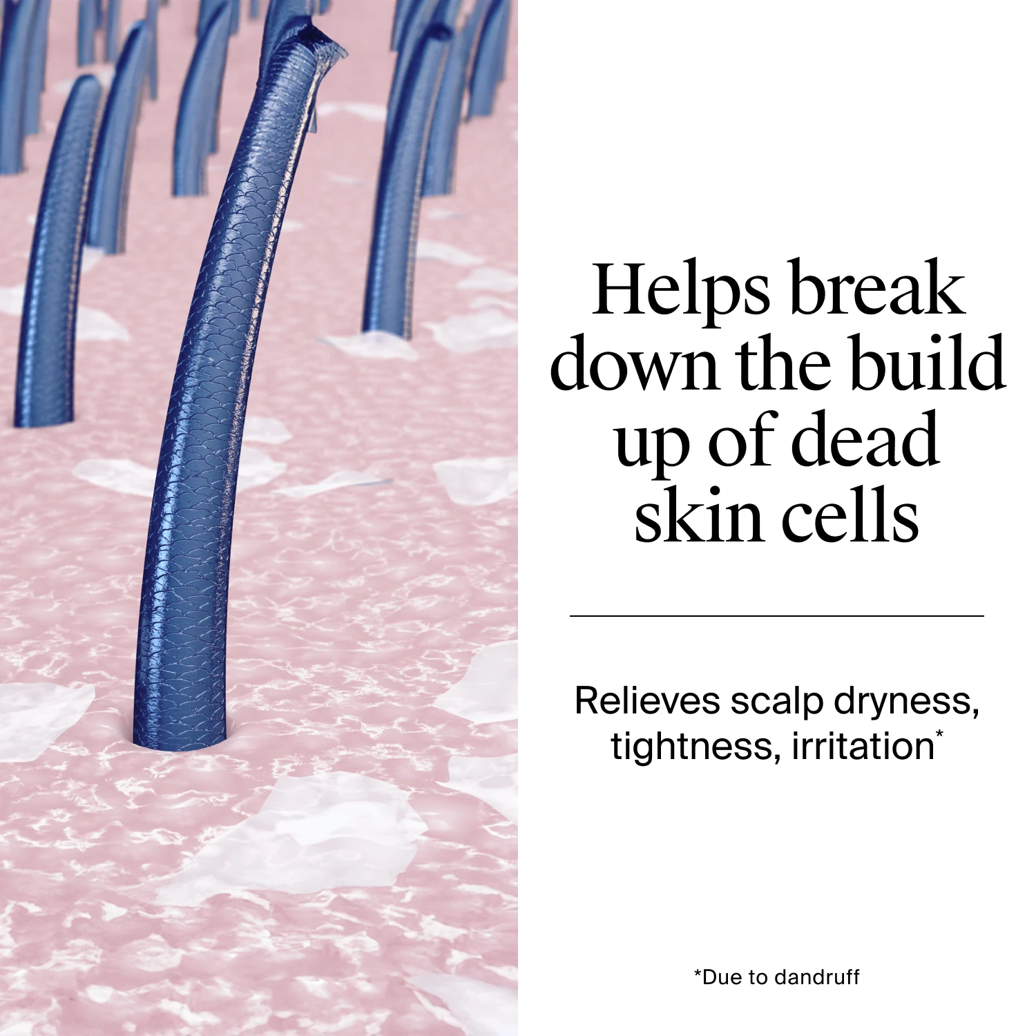 With salicylic acid and piroctone olamine