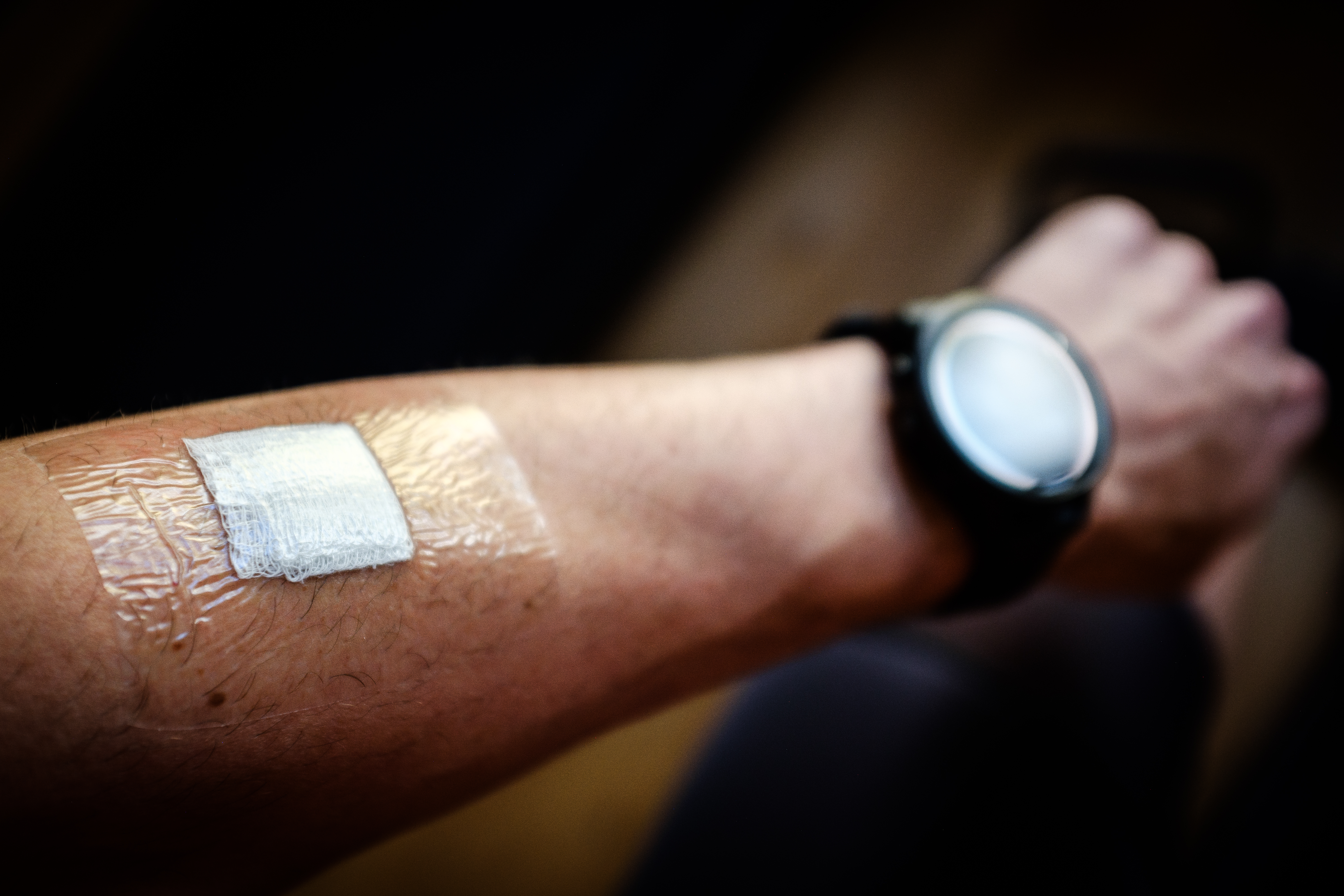 My left arm, with one of the patches for the Levelen sweat test on my forearm. The patch is a small square of gauze held in place by a transparent adhesive film.