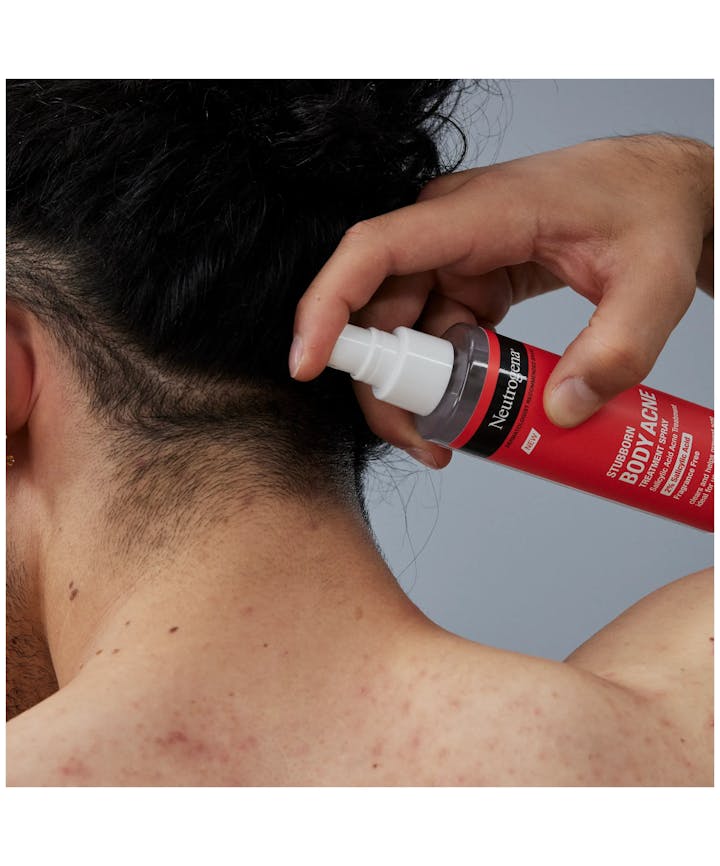 Stubborn Body Acne Treatment Spray for Breakouts, Fragrance Free