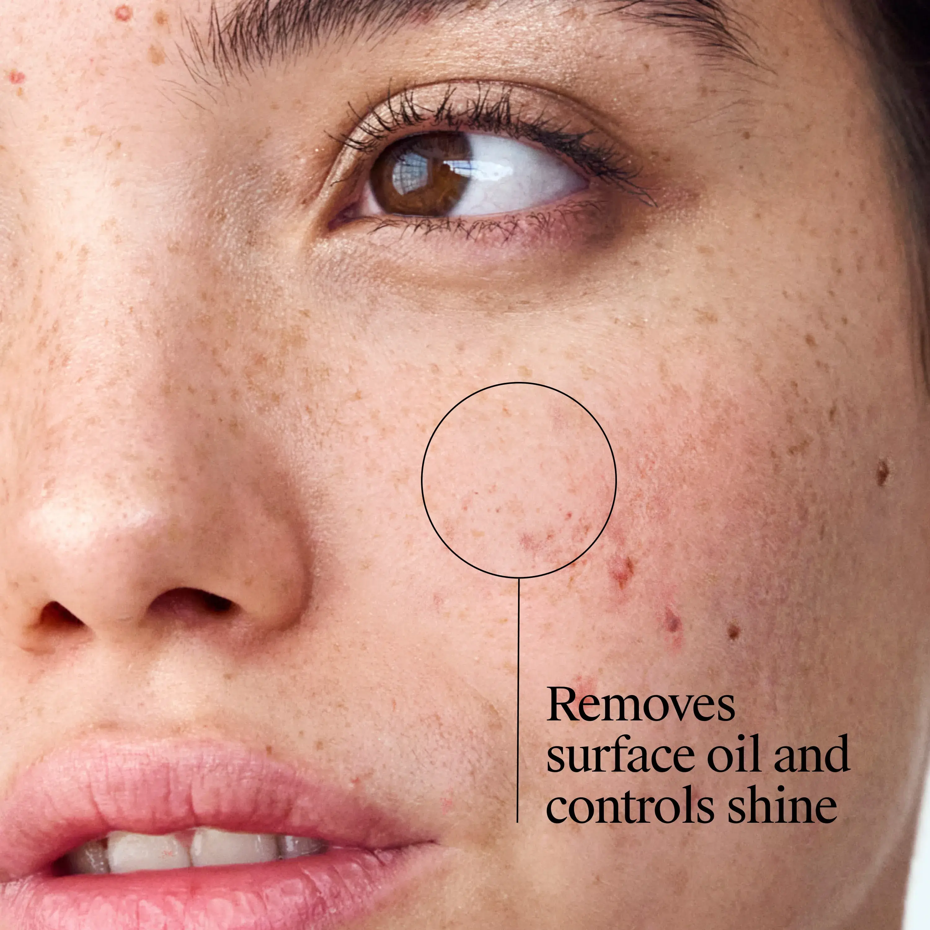 Neutrogena® Clear Pore Oil-Eliminating Astringent removes surface oil and controls shine