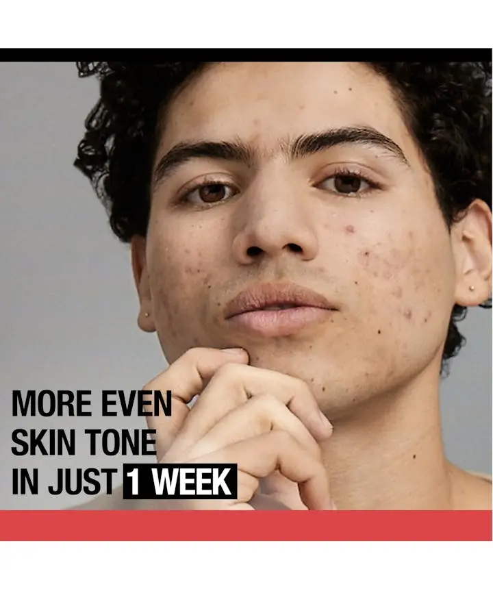 Stubborn Marks PM Treatment